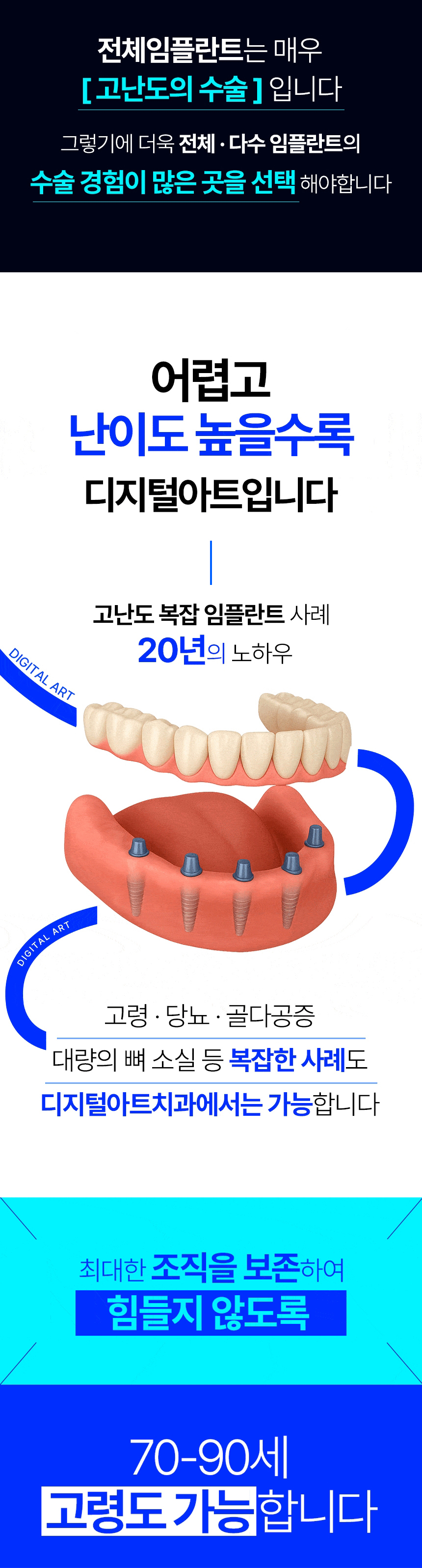 디지털아트치과 전체임플란트