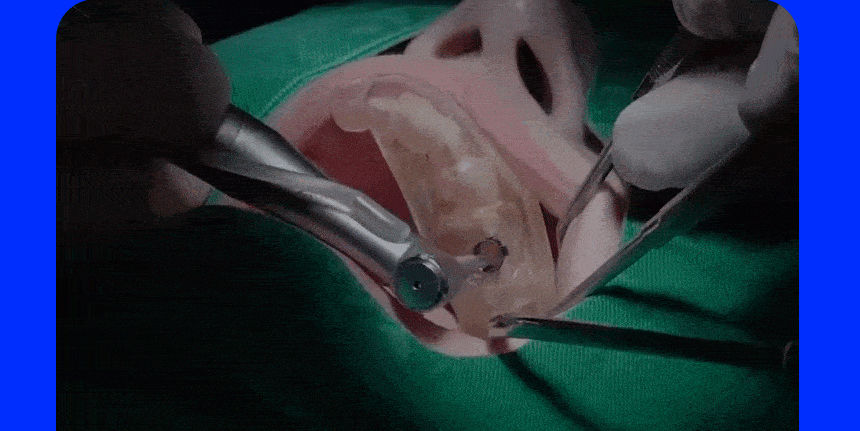 디지털아트치과 전체임플란트