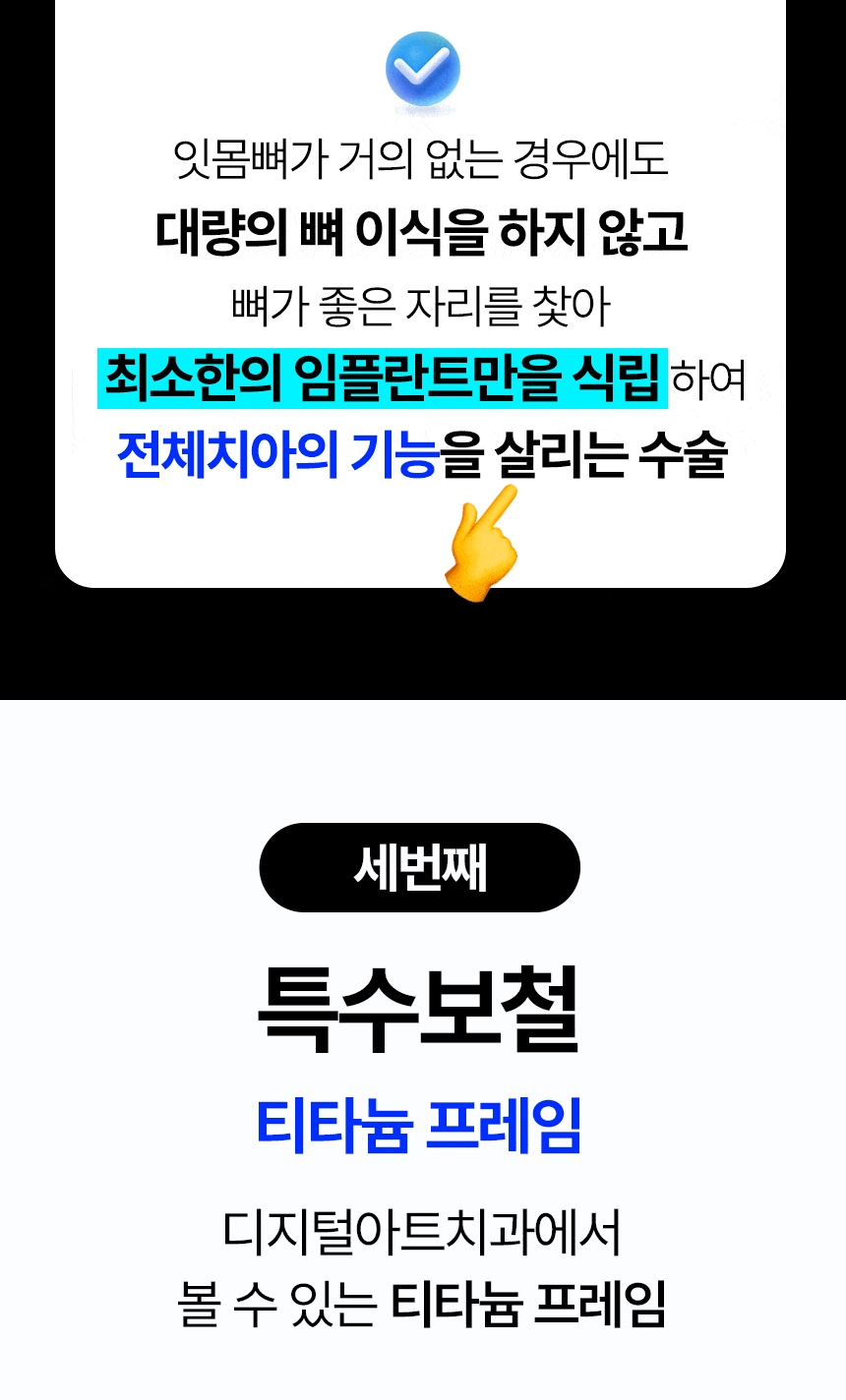 디지털아트치과 전체임플란트