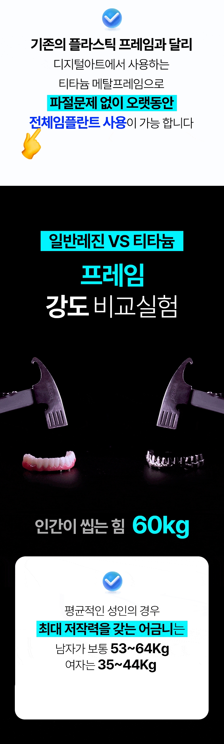 디지털아트치과 전체임플란트