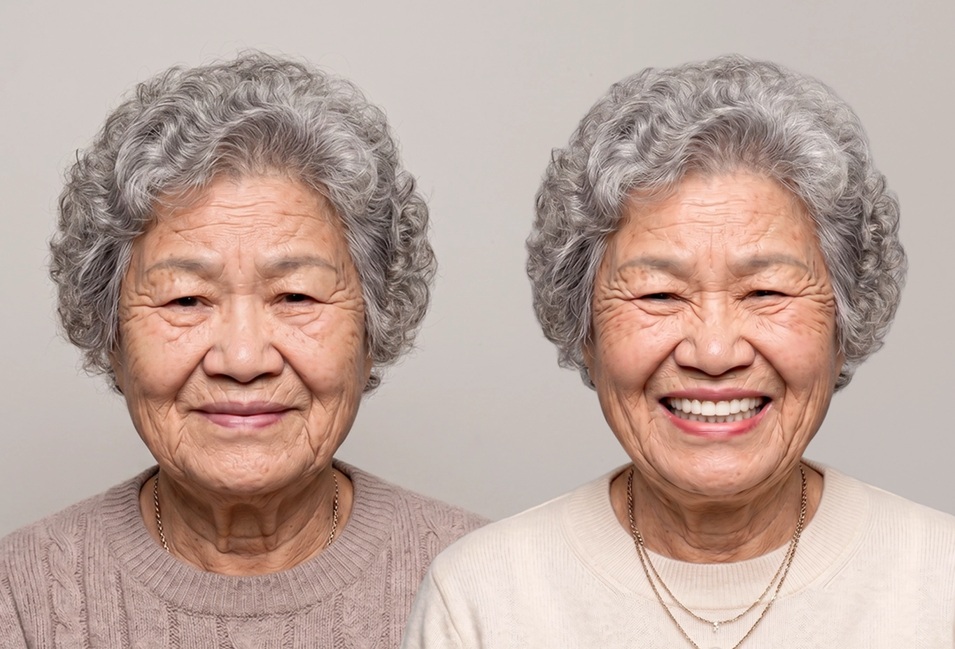 고령 환자를 위한 최소침습 임플란트 상담 이미지