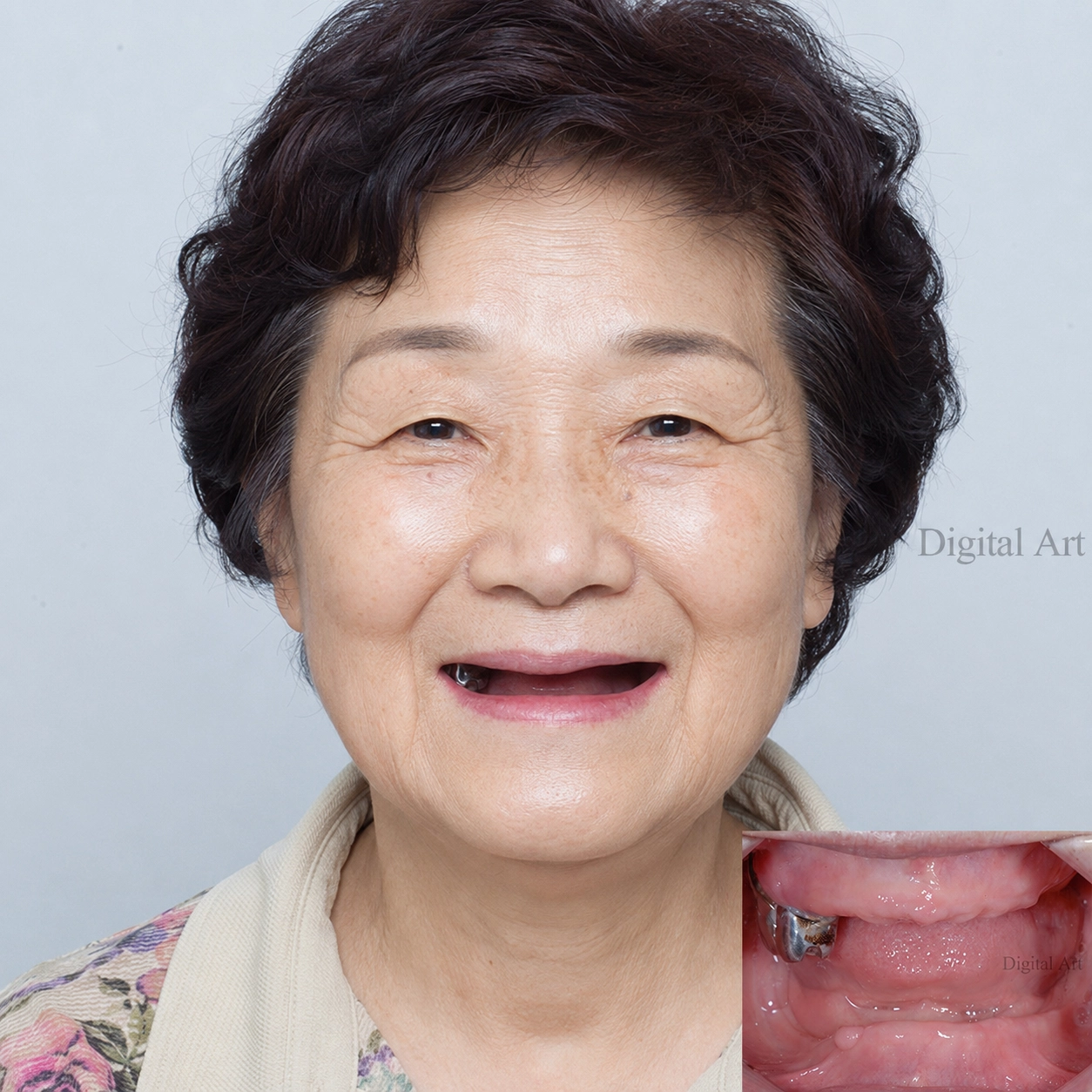 케이스 1 치료 전 사진